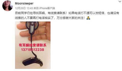 网友爆料耳蜗钉视频大全,网友爆料揭秘耳蜗植入全过程  第2张